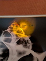 William A. Conklin 1978 Radiographic Photograph Murex Shell — Signed, #39/500