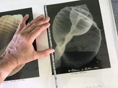 William Conklin Tonna Galea Seashell & X-Ray Photo Framed & Signed Lot 2